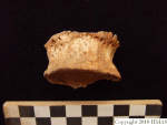 L_V20d5030 A16q142.1 R820 lR ta osteoarthritis.JPG L_V20d5030 A16q142.1 R820 lR ta osteoarthritis